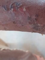 ظهور مرض سريع العدوى بشمال السودان