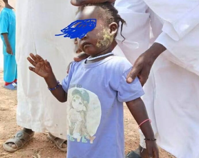 Mysterious skin rash among children in Darfur